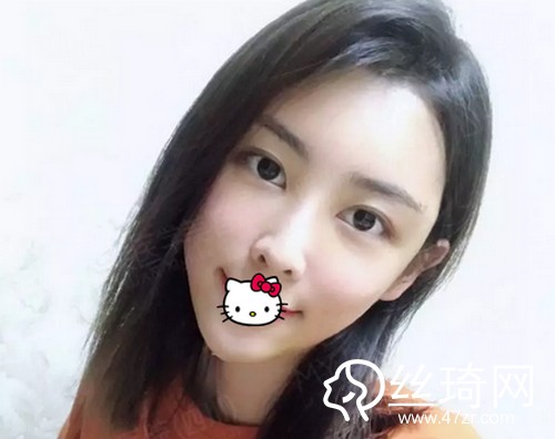 四川美萊醫(yī)學(xué)美容醫(yī)院熊猛怎么樣