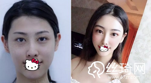 四川美萊醫(yī)學(xué)美容醫(yī)院熊猛怎么樣