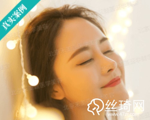 北京禾美嘉醫(yī)療美容自體脂肪填充面部那個醫(yī)生好？