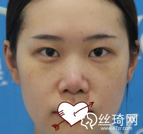 成都恒博醫(yī)院李烈醫(yī)生怎么樣？