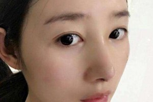 成都雙下巴吸脂多少錢 成都吸脂價(jià)格貴不貴