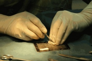 玻尿酸隆鼻也有被嫌棄的時候，你該怎么選?