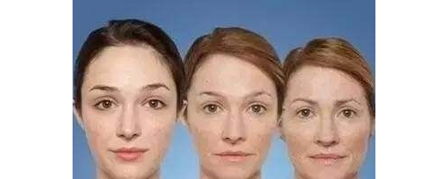 面部年輕化，多方面進入時代