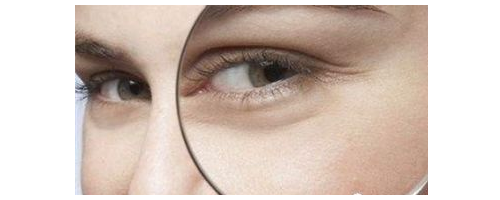 去魚尾紋要多少錢，去魚尾紋價(jià)格貴不貴