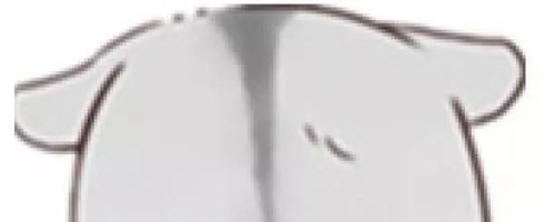 顴骨寬大，選擇顴弓內(nèi)推還是脂肪填充？哪個(gè)能讓臉變小