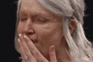 ?抗衰還得靠注射除皺!皺紋形成原因？