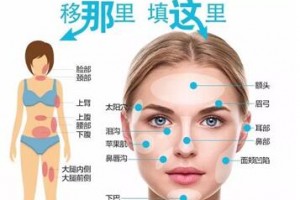 自體脂肪填充，將脂肪變廢為寶！自體脂肪的成活率高嗎