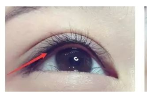 做美瞳線，疼不疼？半永.久美瞳線優(yōu)勢(shì)有哪些