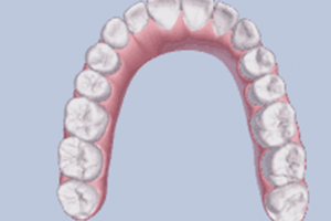 牙齒矯正，要多久? 我32歲可以做矯正嗎？