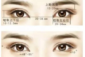 為什么雙眼皮要和開眼角手術(shù)一起做?