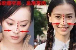 豐厚大鼻子、多肉細(xì)窄鼻子、獅子鼻、希臘鼻各是什么意思