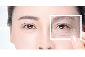 內切去眼袋是什么 內切去眼袋優(yōu)勢和適合人群