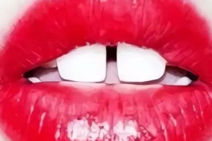 門(mén)牙縫大“漏財(cái)”還毀顏值，整形牙科醫(yī)教你2招關(guān)縫納財(cái)！