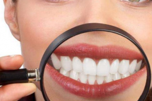 杭州美萊口腔醫(yī)院，口腔知識科普：牙齒美白多少錢一次？