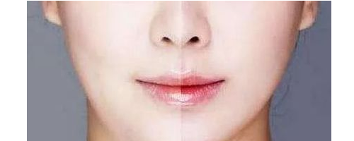 3分鐘，帶你了解醫(yī)美“黑話”