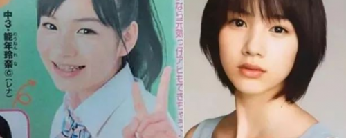 哪些人不適合做開眼角？