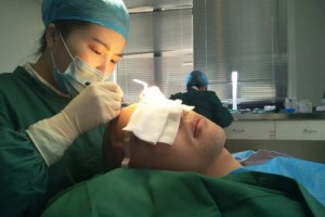 植發(fā)是否成功可以從以下四個方面進行判斷