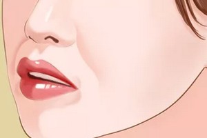 天生法令紋很深怎么辦？