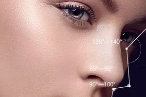 鼻中隔軟骨隆鼻有哪些優(yōu)勢呢