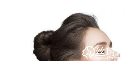 假體填充、玻尿酸填充、自體脂肪填充豐太陽穴各有什么不同之處