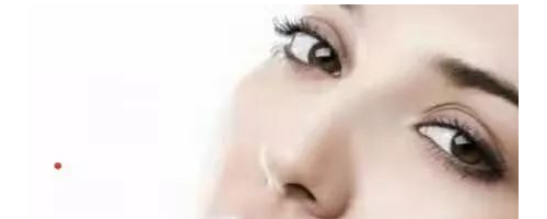 激光脫毛真的是長期性的嗎？