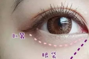 這3個(gè)溝不解決，永遠(yuǎn)顯老！