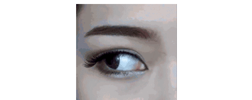 臥蠶?眼袋?淚溝?還在傻傻分不清楚嘛?