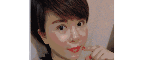 深圳藝星整形醫(yī)生常德成：她脂肪填充后，臉居然變小了？