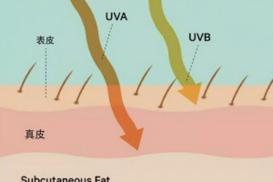 深圳藝星整形醫(yī)生王明海：為什么有些人夏天曬不黑？而你一曬就黑…
