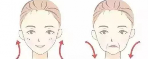 【法令紋】玻尿酸VS埋線提升，去法令紋到底哪個好？