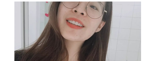 分享一些牙齒矯正的事情，希望能幫到你