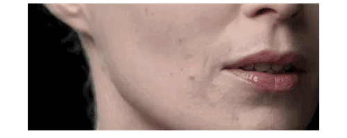 揭開埋線提升秘密，幫你留住仙氣！