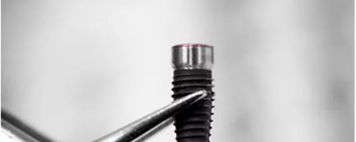 揭秘種植牙內(nèi)幕，種植牙有什么好處？真的是貴嗎？