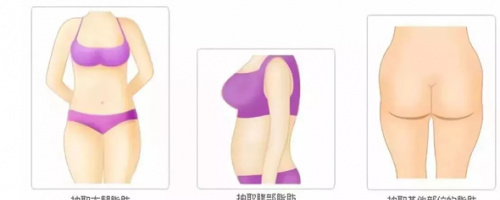 科普你真的了解自體脂肪填充么？