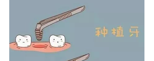 種植牙是在口腔里放一個“種子”讓牙萌出嗎？