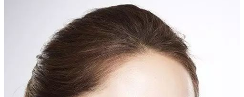 為什么祛斑越祛越多？