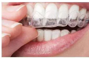 牙齒矯正后，臉會(huì)瘦嗎？臉型會(huì)產(chǎn)生哪些變化