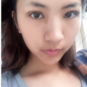 煤炭總醫(yī)院整形科整形價格表一覽及醫(yī)院整形介紹