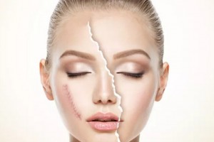 北京伊美爾整形醫(yī)院整形價(jià)格表一覽及醫(yī)院整形介紹