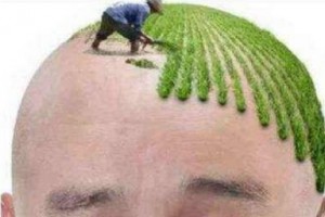 北京瑞麗詩植發(fā)怎么樣附全新價格表(價目表)