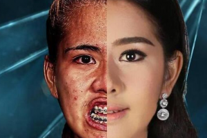 武漢科技大學(xué)附屬天佑醫(yī)院植發(fā)中心怎么樣附全新價格表(價目表)