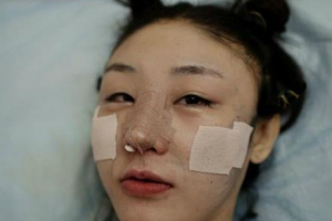 杭州科發(fā)源植發(fā)怎么樣附全新價格表(價目表)