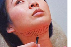 深圳流花醫(yī)院脫發(fā)植發(fā)科怎么樣附全新價格表(價目表)