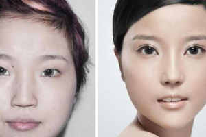 武警遼寧省總隊(duì)醫(yī)院植發(fā)中心怎么樣附全新價(jià)格表(價(jià)目表)