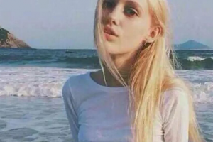 浙江大學(xué)醫(yī)學(xué)院附屬醫(yī)院整形外科整形價格表一覽及醫(yī)院介紹