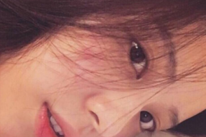 濟(jì)南市皮膚病防治院美容外科整形價(jià)格表(價(jià)目表)全新發(fā)布