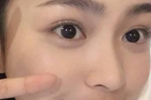 南昌大學(xué)二附院醫(yī)療美容科整形價(jià)格表(價(jià)目表)全新發(fā)布