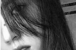 江陰人民醫(yī)院整形美容科整形價格表(價目表)全新發(fā)布