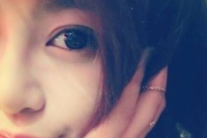 寧夏回族自治區(qū)人民醫(yī)院皮膚科整形價格表(價目表)一覽及醫(yī)院介紹