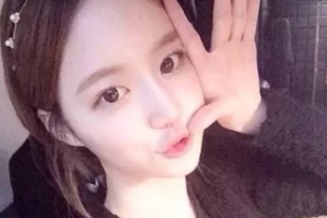 東南大學(xué)附屬中大醫(yī)院燒傷整形科整形價格表(價目表)全新發(fā)布